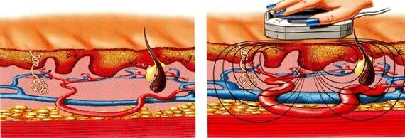 jeśli drętwieją Ci nogi